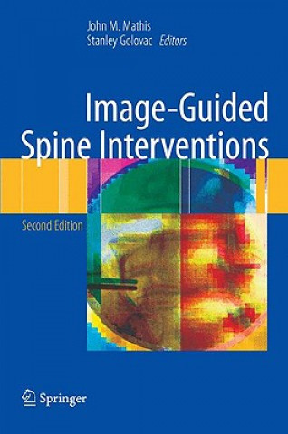 Kniha Image-Guided Spine Interventions John M. Mathis