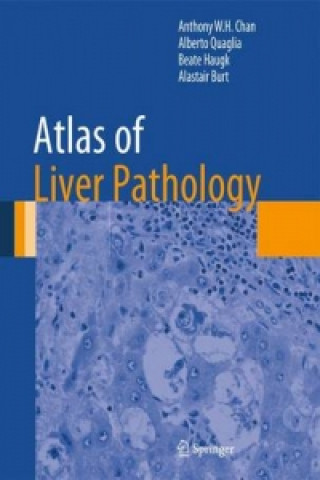 Kniha Atlas of Liver Pathology Anthony W.H. Chan