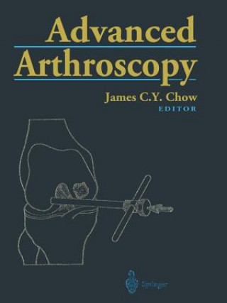 Kniha Advanced Arthroscopy James C.Y. Chow