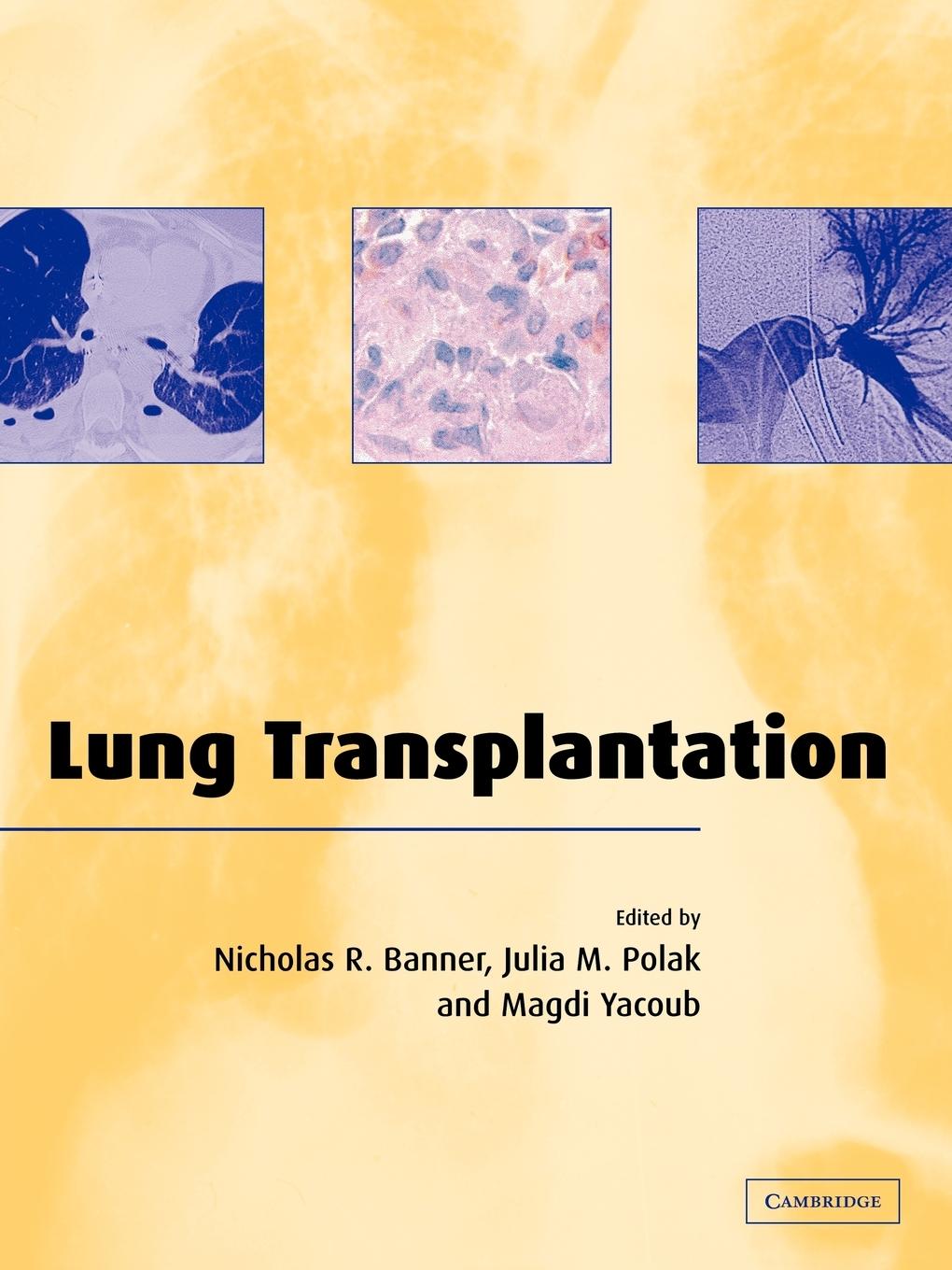 Buch Lung Transplantation Nicholas R. BannerJulia M. PolakMagdi H. Yacoub