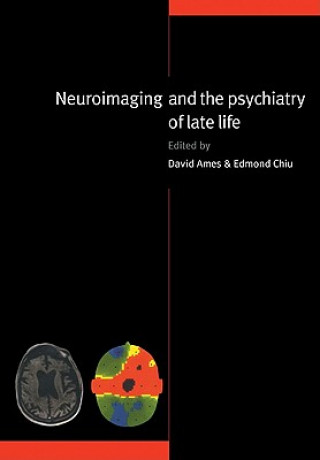 Könyv Neuroimaging and the Psychiatry of Late Life David AmesEdmond ChiuRaymond Levy