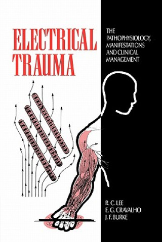 Kniha Electrical Trauma R. C. LeeE. G. CravalhoJ. F. Burke