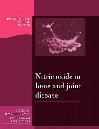 Carte Nitric Oxide in Bone and Joint Disease Mika V. J. HukkanenJulia M. PolakSean P. F. Hughes