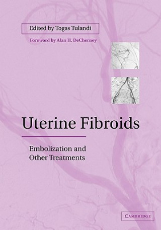 Könyv Uterine Fibroids Togas Tulandi