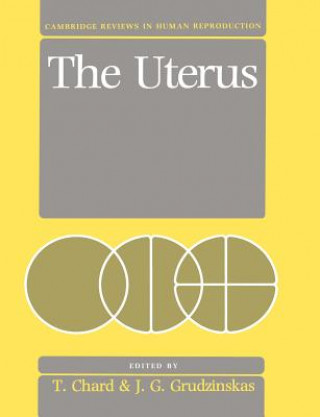 Carte Uterus T. ChardJ. G. Grudzinskas