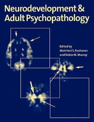 Książka Neurodevelopment and Adult Psychopathology Matcheri S. KeshavanRobin M. MurrayDavid Kupfer