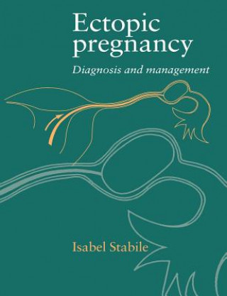 Kniha Ectopic Pregnancy Isabel Stabile
