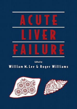 Carte Acute Liver Failure William M. LeeRoger WilliamsJean-Pierre BenhamouJacques Bernuau