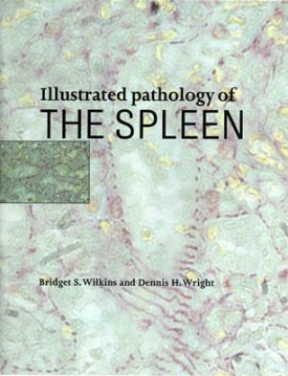 Carte Illustrated Pathology of the Spleen Bridget S. Wilkins