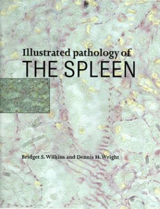 Kniha Illustrated Pathology of the Spleen Bridget S. Wilkins