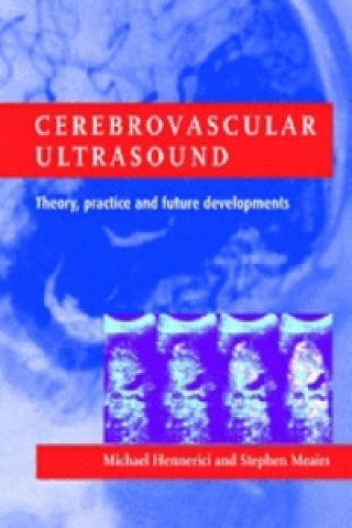 Kniha Cerebrovascular Ultrasound Michael G. HennericiStephen P. Meairs