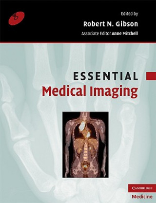 Carte Essential Medical Imaging Robert N. Gibson