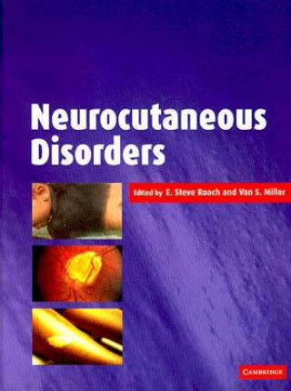 Carte Neurocutaneous Disorders E. Steve RoachVan S. Miller