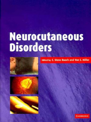 Książka Neurocutaneous Disorders E. Steve RoachVan S. Miller