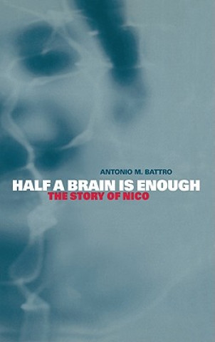 Knjiga Half a Brain is Enough Antonio M. Battro