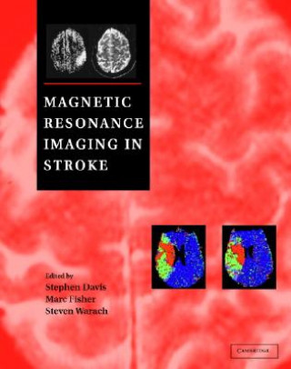 Libro Magnetic Resonance Imaging in Stroke Stephen Davis