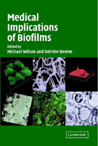 Carte Medical Implications of Biofilms Michael WilsonDeirdre Devine