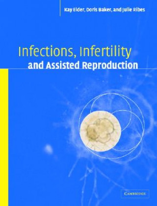 Book Infections, Infertility, and Assisted Reproduction Kay ElderDoris J. BakerJulie A. Ribes