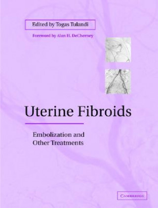 Könyv Uterine Fibroids Togas Tulandi