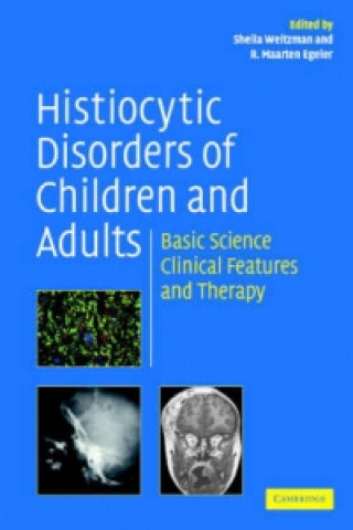 Carte Histiocytic Disorders of Children and Adults Sheila WeitzmanR. Maarten Egeler