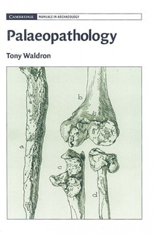 Könyv Palaeopathology Tony Waldron