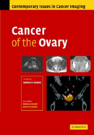 Könyv Cancer of the Ovary Rodney Reznek