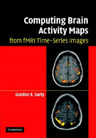 Carte Computing Brain Activity Maps from fMRI Time-Series Images Gordon E. Sarty