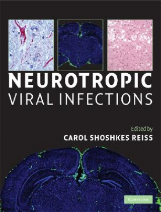 Книга Neurotropic Viral Infections Carol Shoshkes Reiss