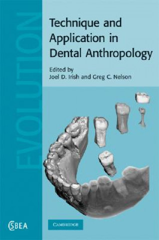 Carte Technique and Application in Dental Anthropology Joel D. IrishGreg C. Nelson