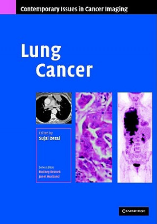 Carte Lung Cancer Sujal R. Desai