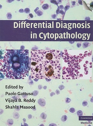 Kniha Differential Diagnosis in Cytopathology with CD-ROM Paolo GattusoVijaya B. ReddyShahla Masood