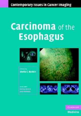 Könyv Carcinoma of the Esophagus Sheila C. Rankin