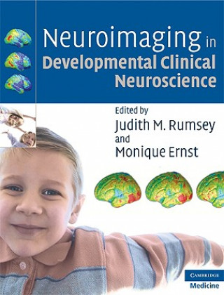 Książka Neuroimaging in Developmental Clinical Neuroscience Judith M. RumseyMonique Ernst