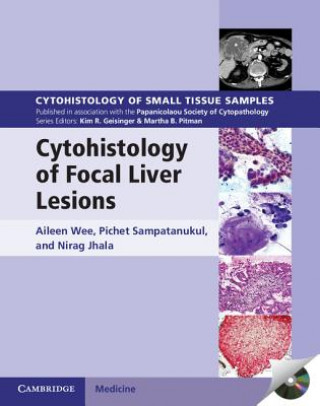 Könyv Cytohistology of Focal Liver Lesions Aileen WeePichet SampatanukulNirag Jhala