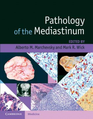 Knjiga Pathology of the Mediastinum Alberto M. MarchevskyMark R. Wick