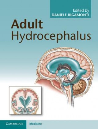 Книга Adult Hydrocephalus Daniele Rigamonti