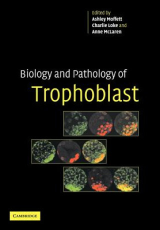 Carte Biology and Pathology of Trophoblast Ashley MoffettCharlie LokeAnne McLaren