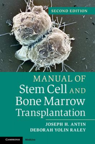 Könyv Manual of Stem Cell and Bone Marrow Transplantation Joseph H. AntinDeborah Yolin Raley