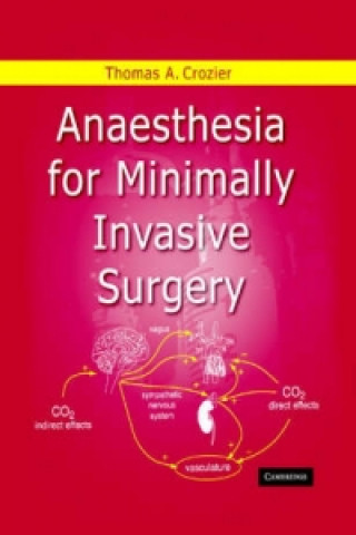 Carte Anaesthesia for Minimally Invasive Surgery Crozier