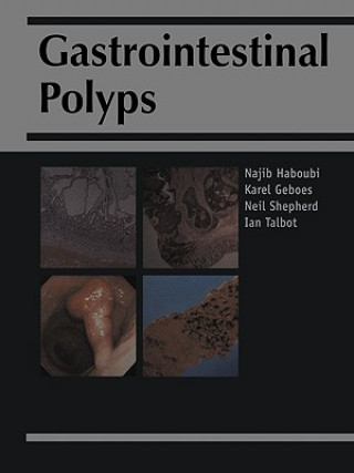 Carte Gastrointestinal Polyps Najib Y. HaboubiKarel GeobesNeil A. ShepherdIan C. Talbot