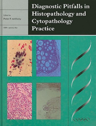 Buch Diagnostic Pitfalls in Histopathology and Cytopathology Practice Peter P. Anthony