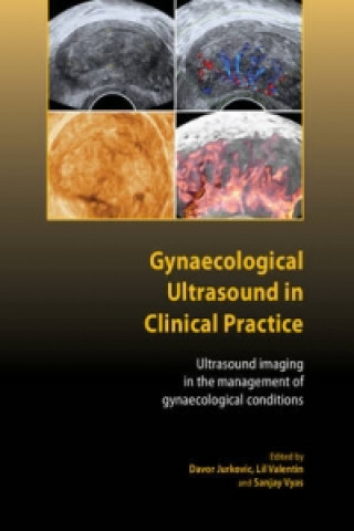 Buch Gynaecological Ultrasound in Clinical Practice Davor JurkovicLil ValentinSanjay Vyas