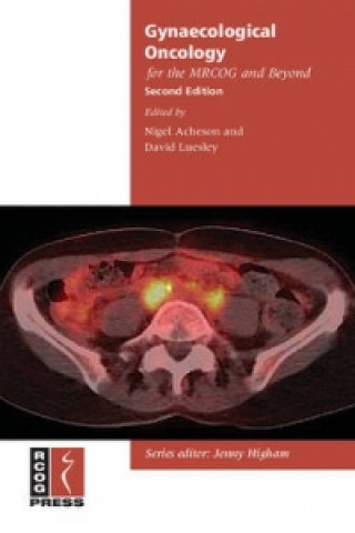 Könyv Gynaecological Oncology for the MRCOG and Beyond Nigel AchesonDavid Luesley