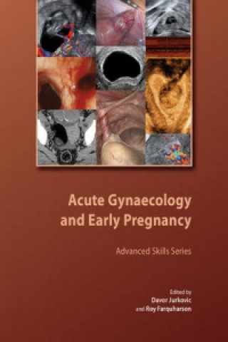Book Acute Gynaecology and Early Pregnancy Davor JurkovicRoy Farquharson