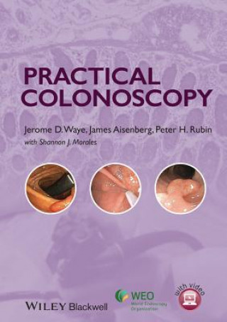 Книга Practical Colonoscopy Jerome D Waye