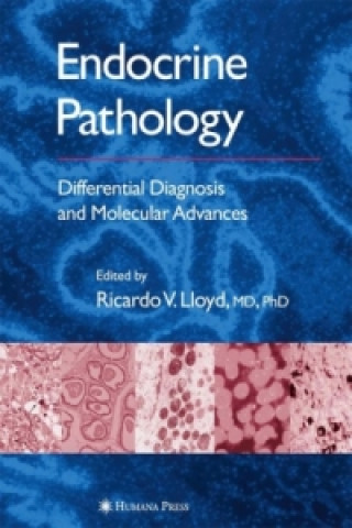 Kniha Endocrine Pathology Ricardo V. Lloyd