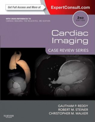 Carte Cardiac Imaging: Case Review Series Gautham P Reddy