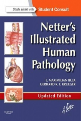 Книга Netter's Illustrated Human Pathology Updated Edition Maximilian L Buja