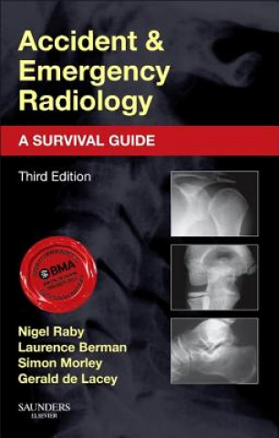 Könyv Accident and Emergency Radiology: A Survival Guide Nigel Raby