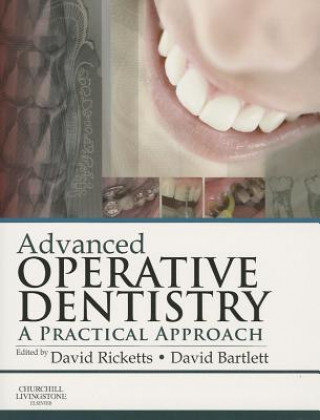 Carte Advanced Operative Dentistry David Ricketts